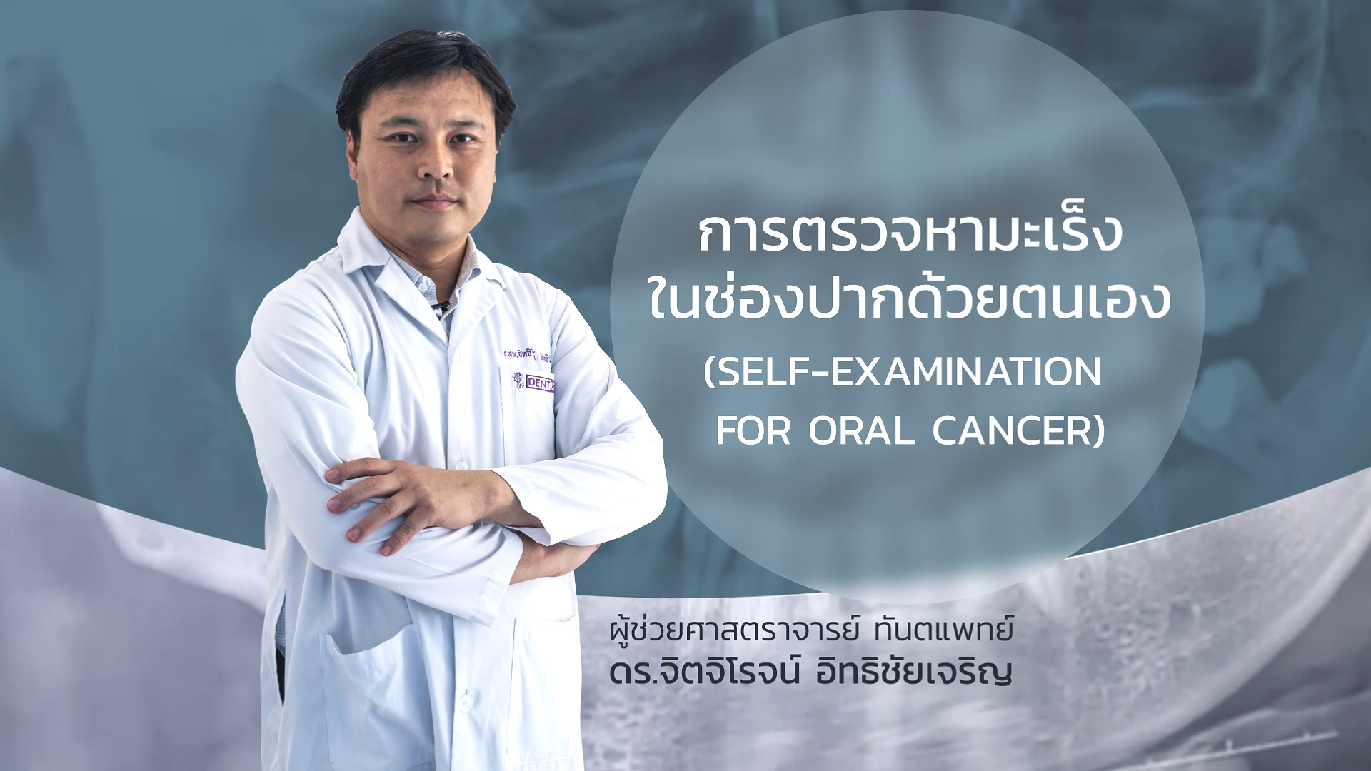 การตรวจมะเร็งในช่องปากด้วยตนเอง | Self-Examination for Oral Cancer 00103
